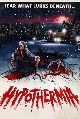 Постер фильма Гипотермия (2010)
