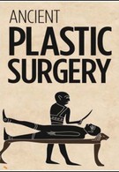 Пластическая хирургия в древности (2005)
