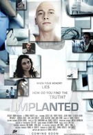 Имплант (2013)